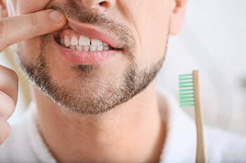 Treating Bleeding Gums Naturally