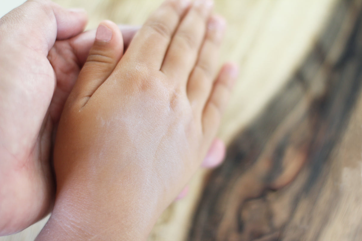 Magic Healer - A Salve that Heals Many Skin Conditions